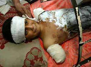 See the source image