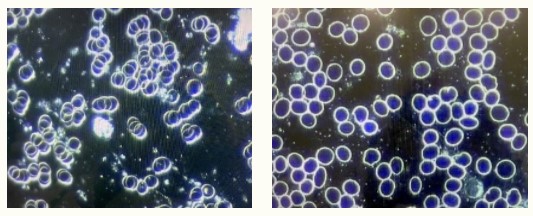 Canceling the Spike Protein - LewRockwell